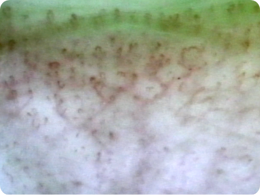 ghost-blood-vessels