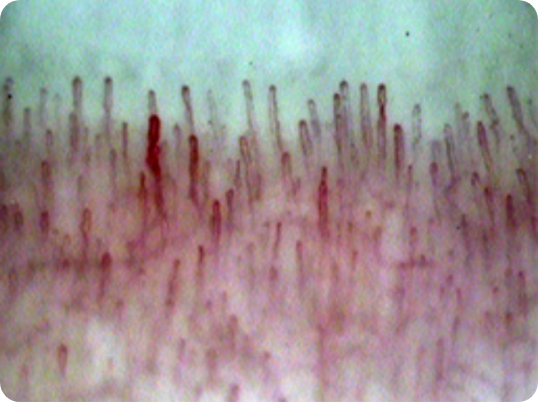 healthy-capillaries